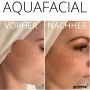 Aqua Facial online Schulung Inkl. Schulungsunterlagen & Zertifikat