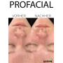 Pro Facial vor Ort Schulung Inkl. Schulungsunterlagen & Zertifikat